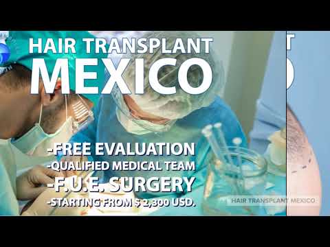 Hair Transplant Mexico1