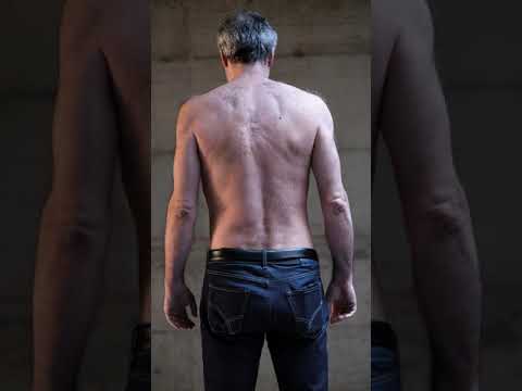 Ignari Totius Corporis