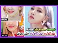 ร้อยไหม หน้าเรียว
