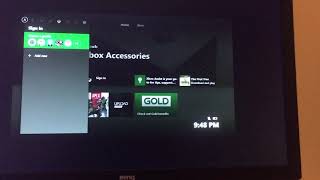 How to fix “small screen” glitch on Xbox 1! (Still working 2023)