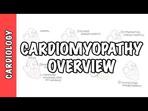 Cardiomyopathy Overview - Types (Dilated, Hypertrophic, Restrictive), Pathophysiology and Treatment