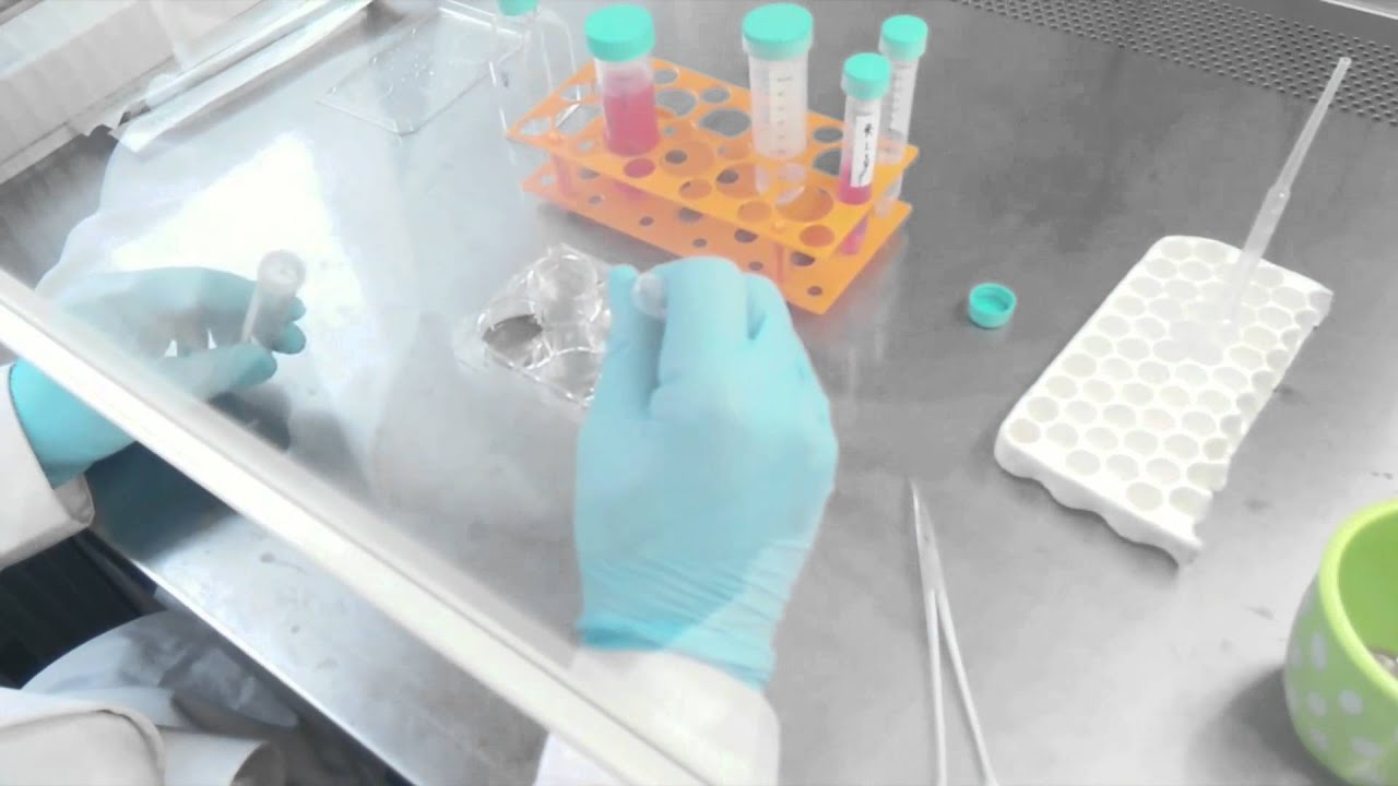 TiO2 nanotubes and behavior of human glioma and osteosarcoma - Video abstract [71622]