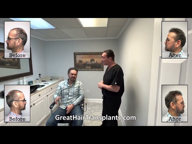 Dr. Brett Bolton Patient Chris Botched Job Corrected Failed FUE / ARTAS Procedure

