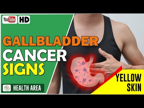 3 Early Warning Signs of Gallbladder Cancer | Gallbladder Cancer Symptoms Video