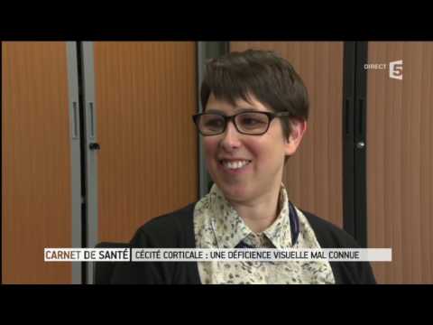 Unité Vision et Cognition, Cécité corticale