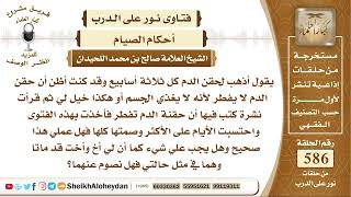 7226 - حكم حقن الدم في رمضان -  نور على الدرب image