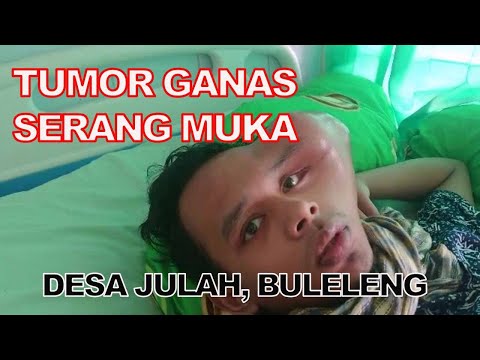 7 BULAN TAK DITANGANI, PADHOLI TUMOR GANAS BAGIAN MUKA DI BULLENG (TVNe Bali)
