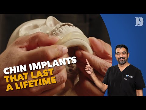 How chin implants can transform your appearance