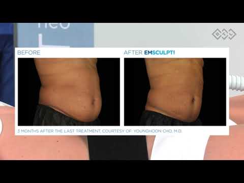 Emsculpt Neo at Jiva Med Spa: Sculpt and Define Your...