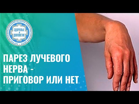 ✍️ Парез лучевого нерва - приговор или нет