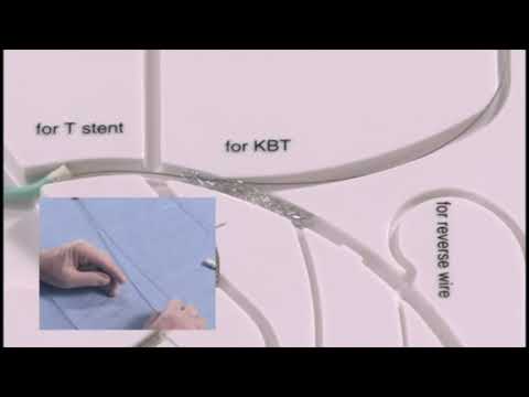 Angioplasty technique: Culotte stent (+English subtitle)