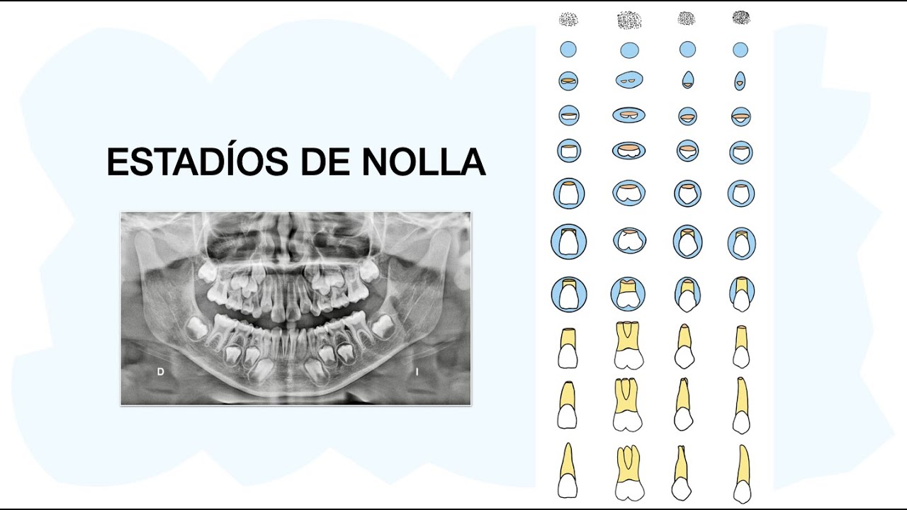 ESTADÍOS DE NOLLA 🦷✅ Desarrollo de dientes permanentes