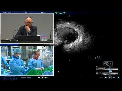 [TCTAP 2018] Master the CTO - Live Case Session III