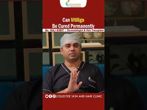 బొల్లి మచ్చలు శాశ్వతంగా పోవాలంటే | How to Cure Vitiligo Permanently in Telugu | Celestee Skin Clinic