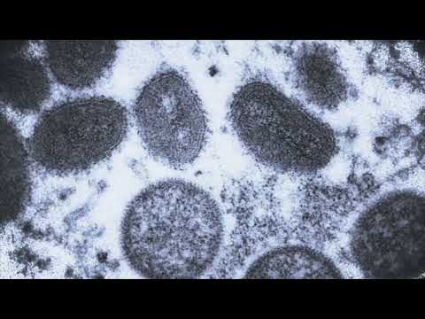 NJ Monkeypox Case