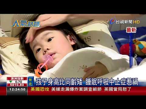 孩子身高比同齡矮睡眠呼吸中止症惹禍