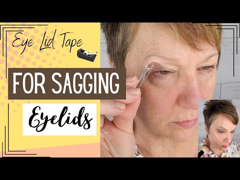 Eyelid tape, does it work?