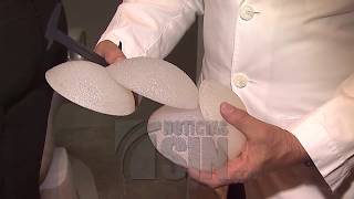 Riesgos de los implantes de senos y de glúteos