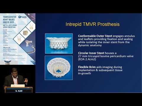 S. Kar  | Currently enrolling TMVR and TTVR FIM and CE Mark trials