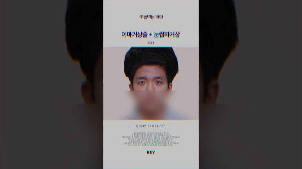 20대 이마거상 대구키성형외과