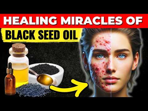 10 Black Seed Oil Benefits (95% of People DON'T Know These Health Benefits of Black Seed Oil)