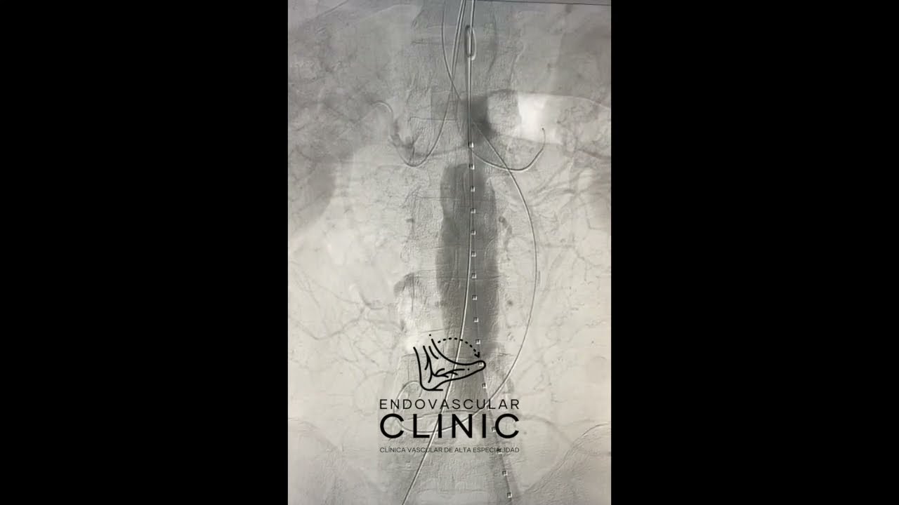 Rigoberto Roman Hernandez-2