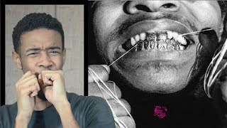 Injury Reserve - FLOSS First REACTION/REVIEW