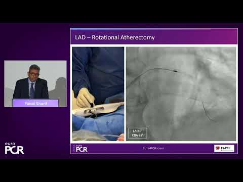 Simplifying complex coronary interventions by adopting angiography-based physiology - EuroPCR 2022