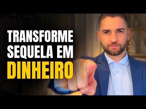 O que é AUXÍLIO-ACIDENTE do INSS e como RECEBER?