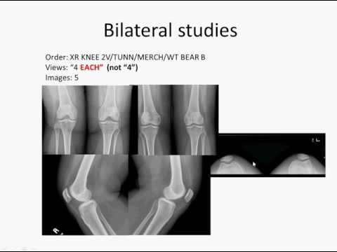 XR tech note update 8-23-2016
