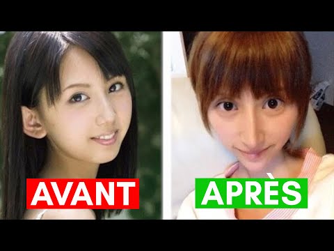 chirurgie des yeux au Japon