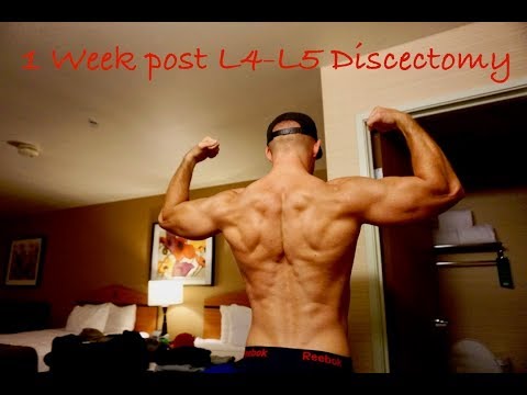 1 Week Post L4-L5 Discectomy