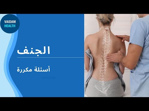 الأسئلة المتداولة حول الجنف