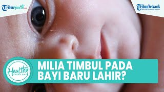 Benarkah Milia Dapat Timbul pada Bayi Baru Lahir? Kenali Penyebab dan Dampaknya