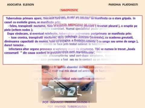 burner de grăsime kapseln