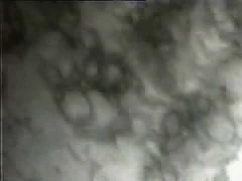 Movimentação de Discordâncias   Parte 1