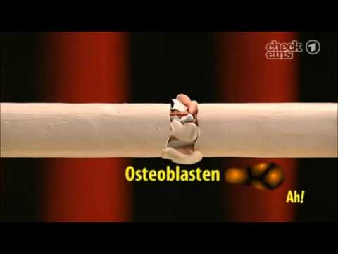 Schmerzen nach einer Kerze vitaprost Einnahme Antibiotika für Prostatitis am effektivsten