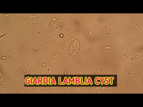 Giardia lamblia cyst under microscope. Best clear view