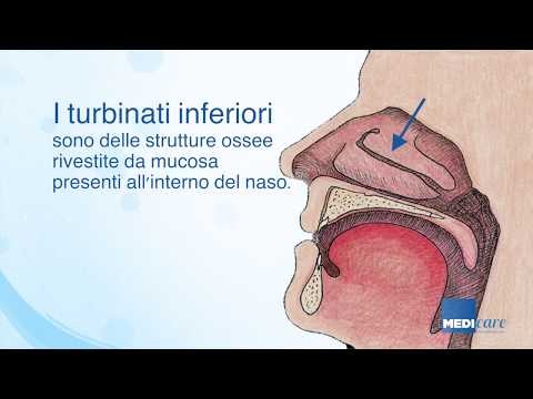 Fisioterapia con ernia intervertebrale Trattamento bile dei giunti