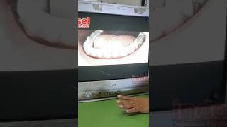 Download lagu TV Tabung Gambar Mengecil Atas Bawah, Solusi Hanya Disetting Dari Remout mp3