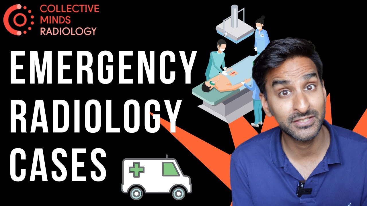 Emergency CT Abdomen Cases - made easy!?