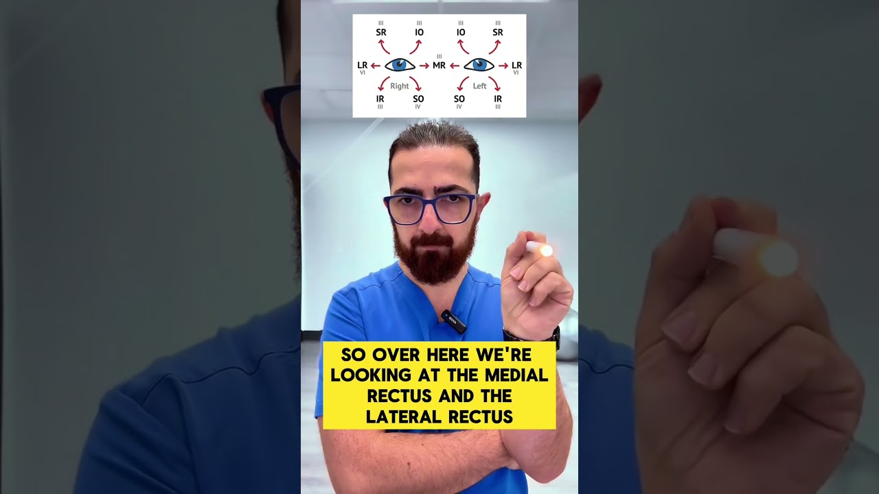 POV: Do the H test with Dr