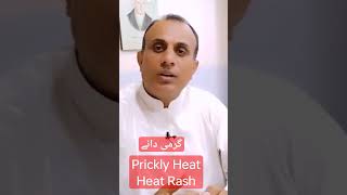 گرمی دانے | Prickly Heat #dralimaher #skincare #baby