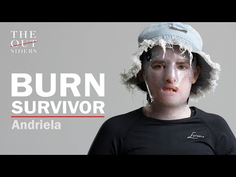 The Outsiders / Burn Survivor / Andriela