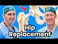 Don T Make These Mistakes After Hip Replacement