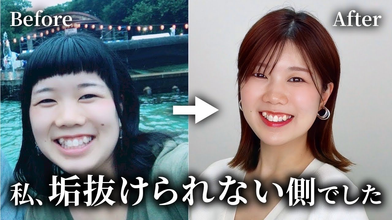 【私、垢抜けられない側でした】おしゃれとは無縁だった私が垢抜けられた理由