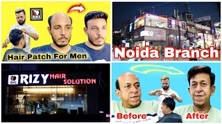 Hair Patch For Men | Best Hair Patch Centre In Noida  Branch | low price hair patch | 9971376874 |