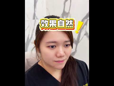 Smaller Face, Sharper V-Line:30 years old shares Her Sculptra® Secrets