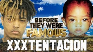 XxxTENTACION - Before They Were Famous - Jahseh Onfroy