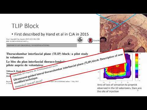 The Thoraco-Lumbar Interfascial Plane (TLIP) Block - Regional Analgesia for the Spine